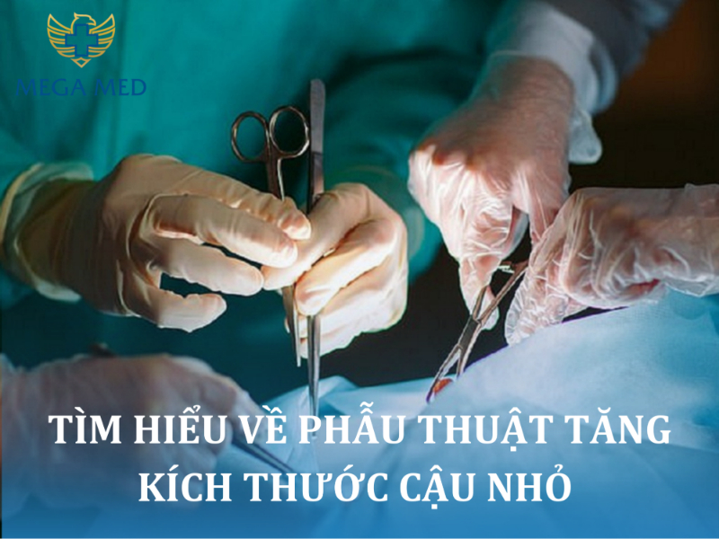 phẫu thuật tăng kích thước cậu nhỏ